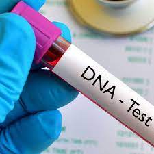 DNA-Test